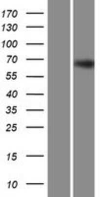 Western Blot: Zinc finger protein 668 Overexpression Lysate [NBP2-06304]