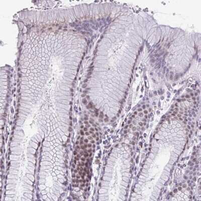 Immunohistochemistry-Paraffin: Zinc finger protein 682 Antibody [NBP2-33773]