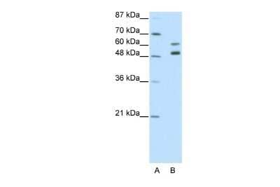 Western Blot: Zinc finger protein 682 Antibody [NBP2-83806]