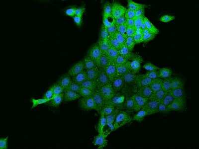 Immunocytochemistry/ Immunofluorescence: Zinc finger protein 772 Antibody [NBP2-98164]