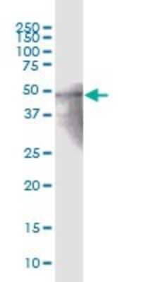 Western Blot: Zinc finger protein 772 Antibody [H00400720-B01P]