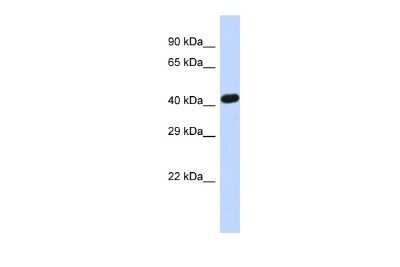 Western Blot: Zinc finger protein 773 Antibody [NBP2-83809]