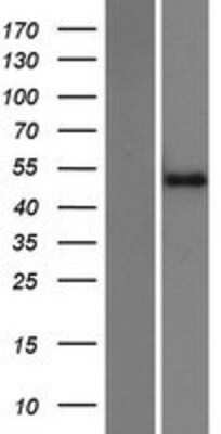 Western Blot: Zinc finger protein 773 Overexpression Lysate [NBP2-04679]