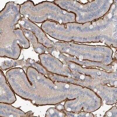 Immunohistochemistry-Paraffin: Zinc finger protein 793 Antibody [NBP1-87517]