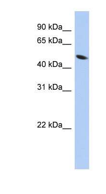 Western Blot: Zinc finger protein 793 Antibody [NBP1-79359]