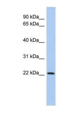 Western Blot: Zinc finger protein 833 Antibody [NBP1-79360]