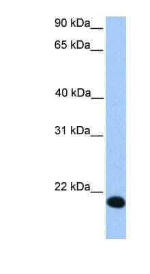 Western Blot: Zinc finger protein 833 Antibody [NBP1-79361]