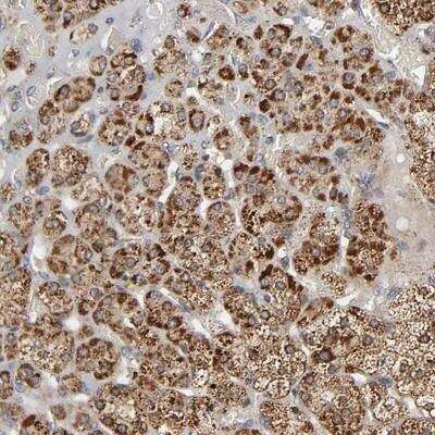 Immunohistochemistry: Zinc transporter 9 Antibody [NBP1-88261]