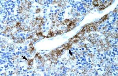 Immunohistochemistry: Zinc transporter 9 Antibody [NBP2-83813]