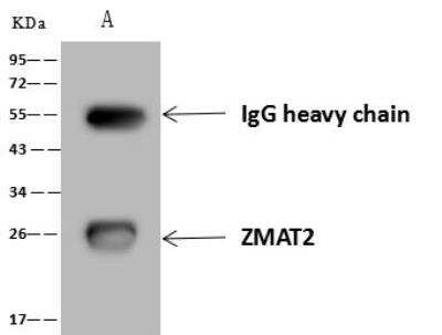 Immunoprecipitation: Zmat2 Antibody [NBP3-12674]