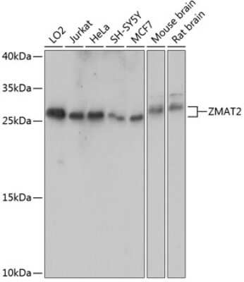 Western Blot: Zmat2 AntibodyAzide and BSA Free [NBP2-93307]