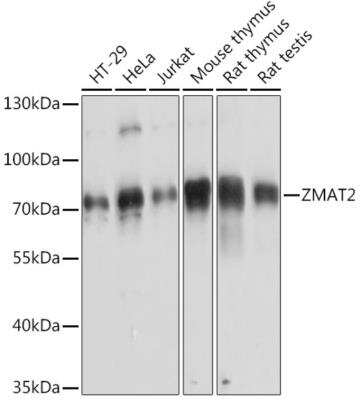 Western Blot: Zmat2 AntibodyAzide and BSA Free [NBP2-94339]