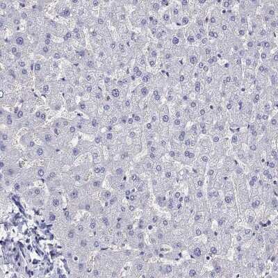 Immunohistochemistry-Paraffin: ZnT-8/SLC30A8 Antibody [NBP2-62701]