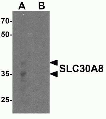 Western Blot: ZnT-8/SLC30A8 AntibodyBSA Free [NBP2-82056]