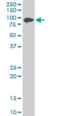 Western Blot: Zyxin Antibody (2D1) [H00007791-M02]