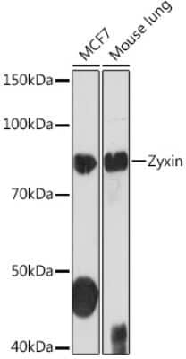 Western Blot: Zyxin Antibody (4F9P3) [NBP3-16109]