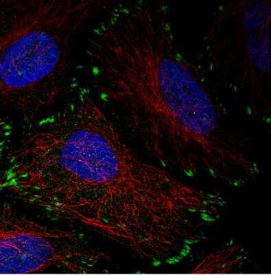 Immunocytochemistry/ Immunofluorescence: Zyxin Antibody (CL2502) [NBP2-36768]