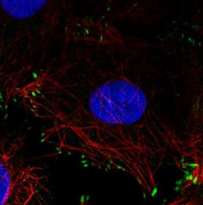 Immunocytochemistry/ Immunofluorescence: Zyxin Antibody (CL2502) [NBP2-36768]