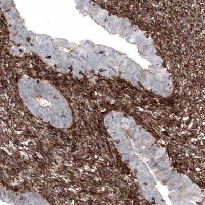 Immunohistochemistry-Paraffin: Zyxin Antibody (CL2502) [NBP2-36768]