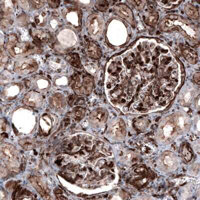 Immunohistochemistry-Paraffin: Zyxin Antibody (CL2502) [NBP2-36768]