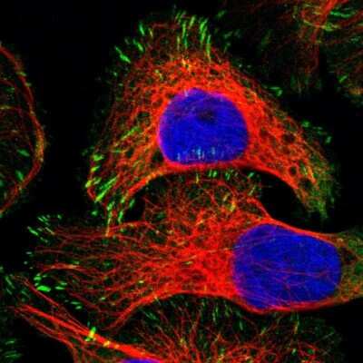 Immunocytochemistry/ Immunofluorescence: Zyxin Antibody [NBP1-90349]