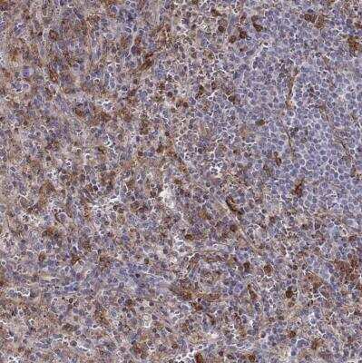 Immunohistochemistry-Paraffin: Zyxin Antibody [NBP2-54751]