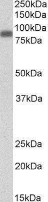 Western Blot: Zyxin Antibody [NBP1-46135]