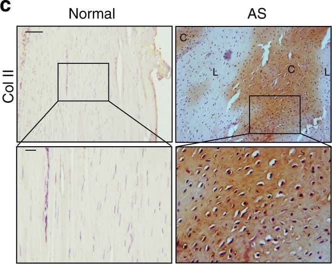 Detection of Human Normal Rabbit IgG Control by Immunohistochemistry
