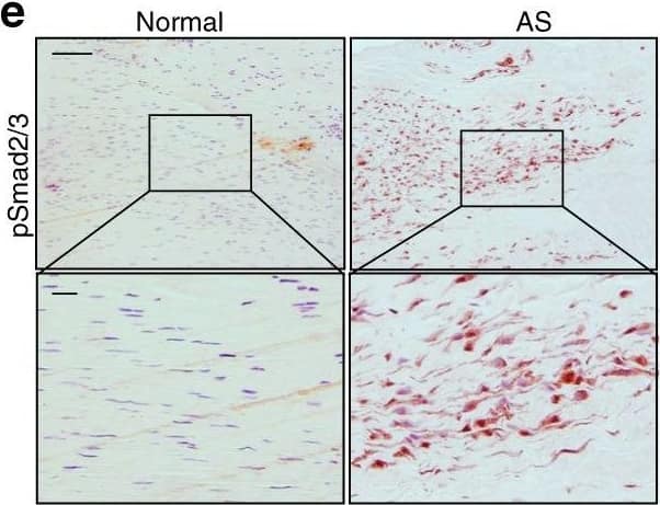 Detection of Human Normal Rabbit IgG Control by Immunohistochemistry