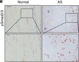 Detection of Human Normal Rabbit IgG Control by Immunohistochemistry