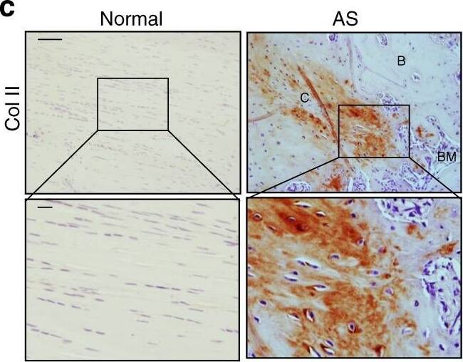 Detection of Human Normal Rabbit IgG Control by Immunohistochemistry