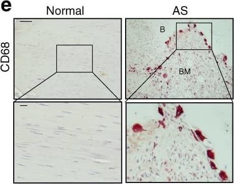 Detection of Human Normal Rabbit IgG Control by Immunohistochemistry