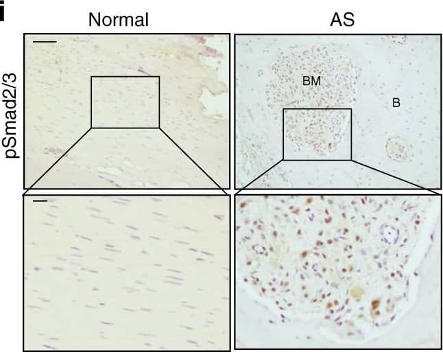Detection of Human Normal Rabbit IgG Control by Immunohistochemistry