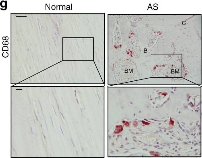 Detection of Human Normal Rabbit IgG Control by Immunohistochemistry
