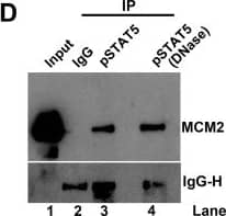 Detection of Human IgG by Western Blot