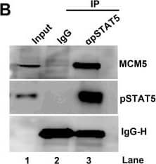 Detection of Human IgG by Western Blot