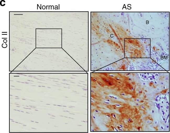 Detection of Human Normal Goat IgG Control by Immunohistochemistry