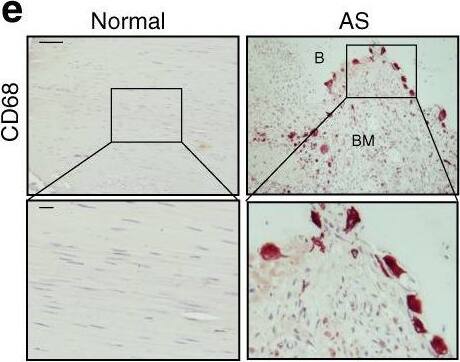 Detection of Human Normal Goat IgG Control by Immunohistochemistry