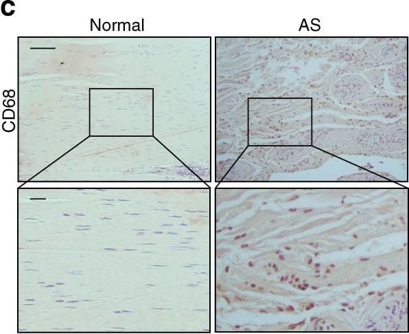 Detection of Human Normal Goat IgG Control by Immunohistochemistry