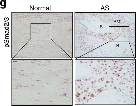 Detection of Human Normal Goat IgG Control by Immunohistochemistry