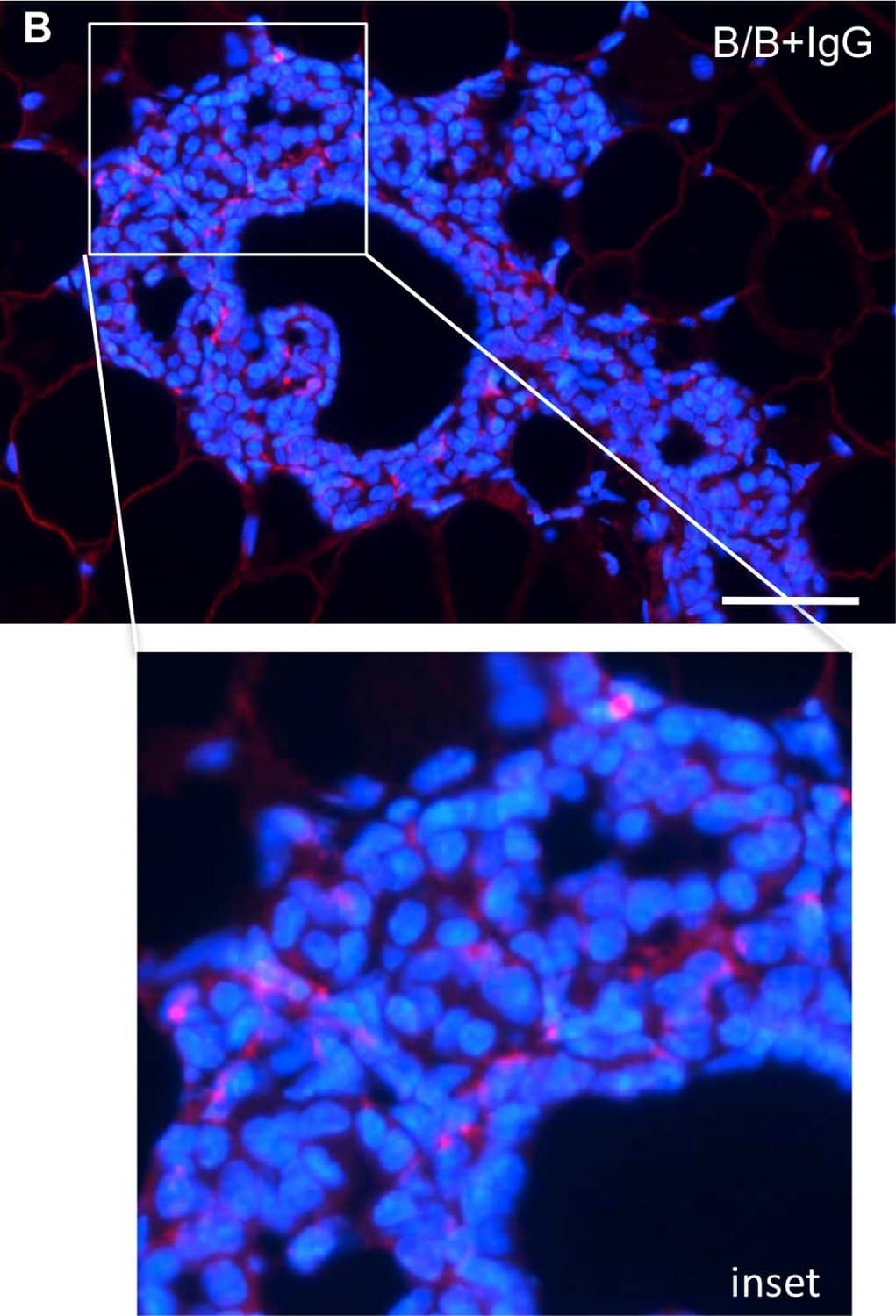 Detection of Normal Goat IgG Control by Immunocytochemistry/ Immunofluorescence