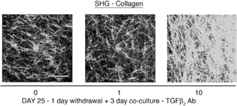 Detection of Human TGF-beta 2 by Immunocytochemistry/ Immunofluorescence