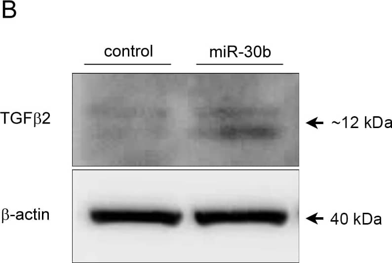 Detection of Human TGF-beta 2 Antibody by Western Blot