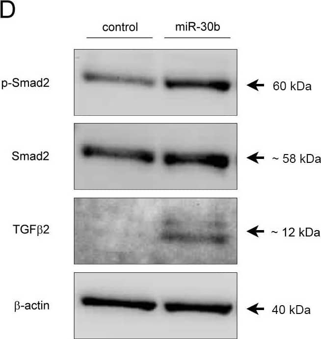 Detection of Human TGF-beta 2 Antibody by Western Blot