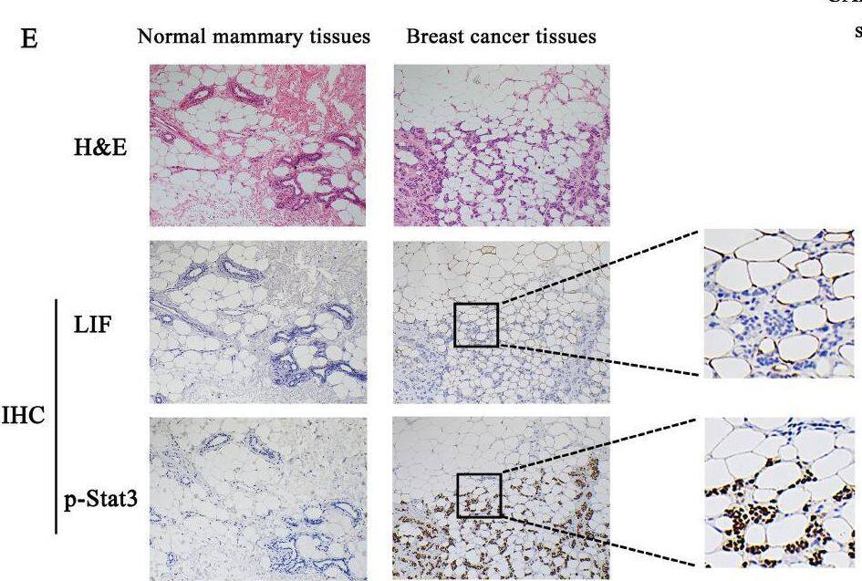 Detection of LIF by Immunohistochemistry