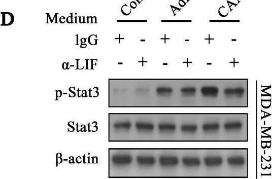Detection of LIF by Western Blot