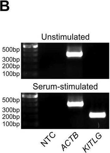 Detection of SCF/c-kit Ligand by Western Blot