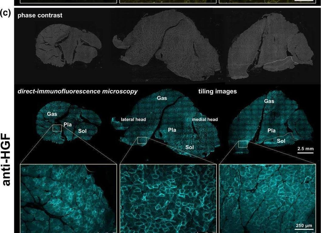 Detection of HGF by Immunohistochemistry