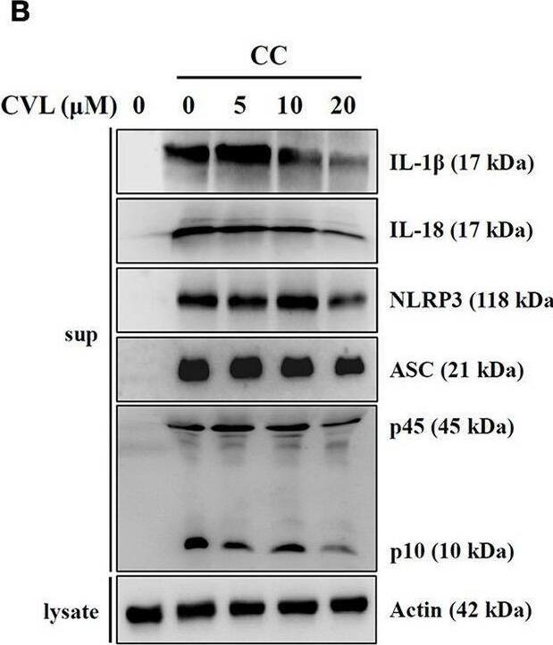 Detection of IL-1 beta/IL-1F2 by Western Blot