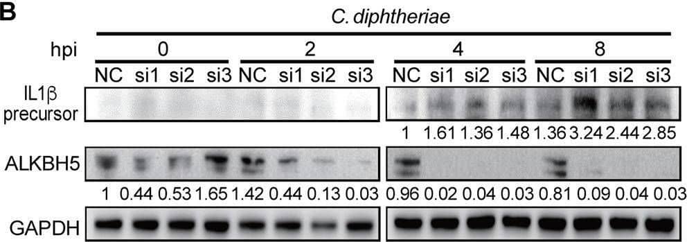 Detection of IL-1 beta/IL-1F2 by Western Blot